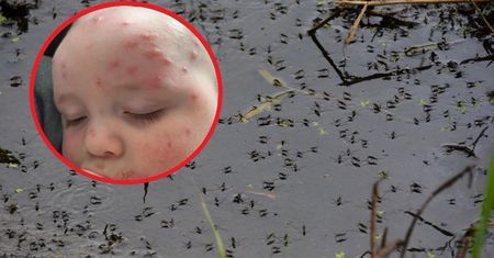 Pojawiają się po ukąszeniu. Gdy je zauważysz, biegiem do lekarza