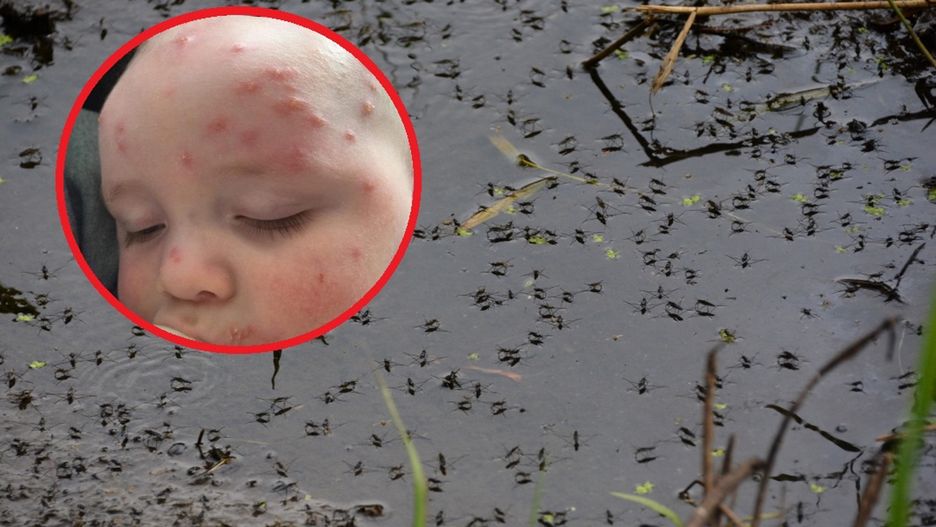 Pojawiają się po ukąszeniu. Gdy je zauważysz, biegiem do lekarza