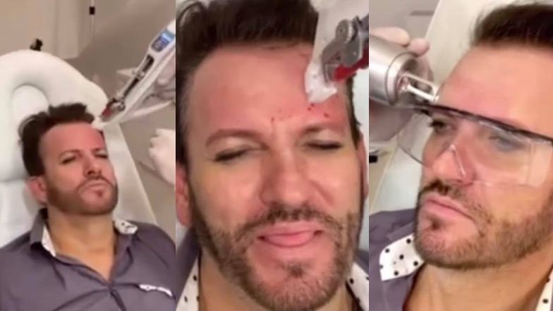 Gabriel Seweryn zagęszcza skórę laserem