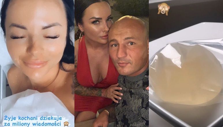 Dziewczyna Artura Szpilki usunęła implanty piersi
