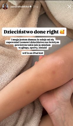 Sandra Kubicka pokazała siniaki na nodze syna