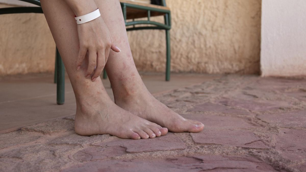 Układowe zapalenia naczyń. Nierozpoznane doprowadzają nawet do śmierci