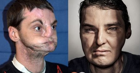 Mężczyzna z przeszczepioną twarzą trafił... NA OKŁADKĘ "GQ"!