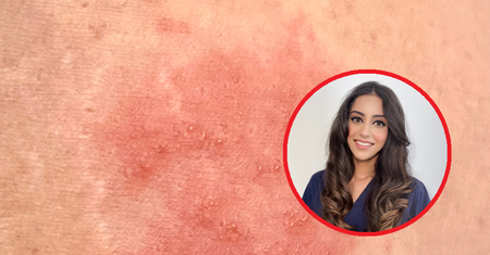 Dermatolożka ostrzega. Ten nawyk może skończyć się infekcją mózgu