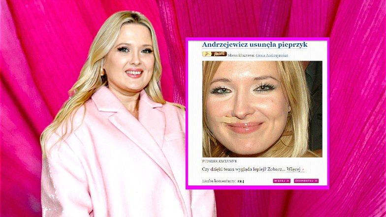 #18 lat temu na Pudelku: Gosia Andrzejewicz usunęła sobie PIEPRZYK!