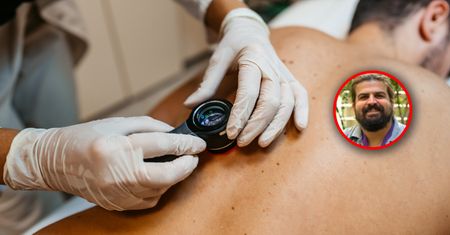 Cząsteczka, która napędza czerniaka. Odkrycie może pomóc w leczeniu