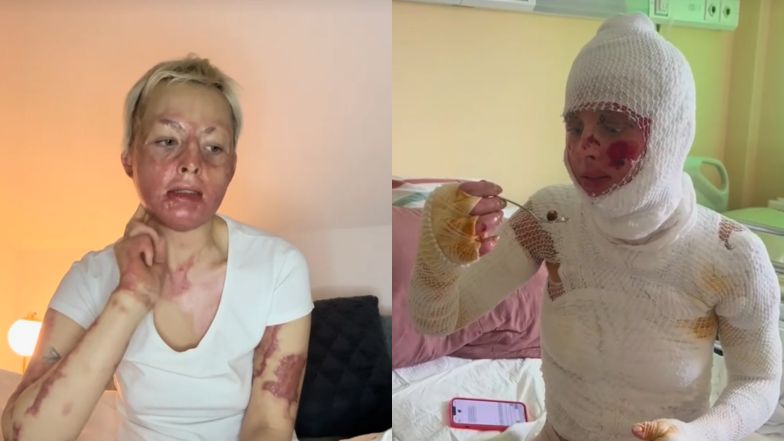 Dramatyczne przeżycia tiktokerki