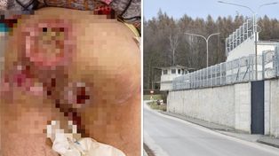 Pogarsza się stan niepełnosprawnego, który w lutym wyszedł z Zakładu Karnego w Pińczowie