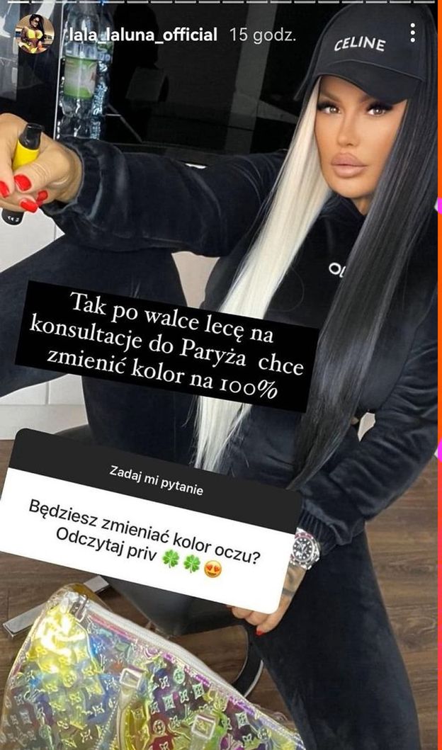 Laluna Unique z "Królowych życia" przymierza się do KOLEJNEGO ZABIEGU. Szokujące, co planuje: "Lecę na konsultacje do Paryża"