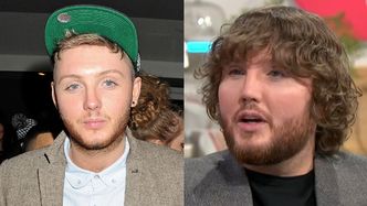 James Arthur zaskakuje NOWĄ TWARZĄ. Bardzo się zmienił od czasów "X Factor"?