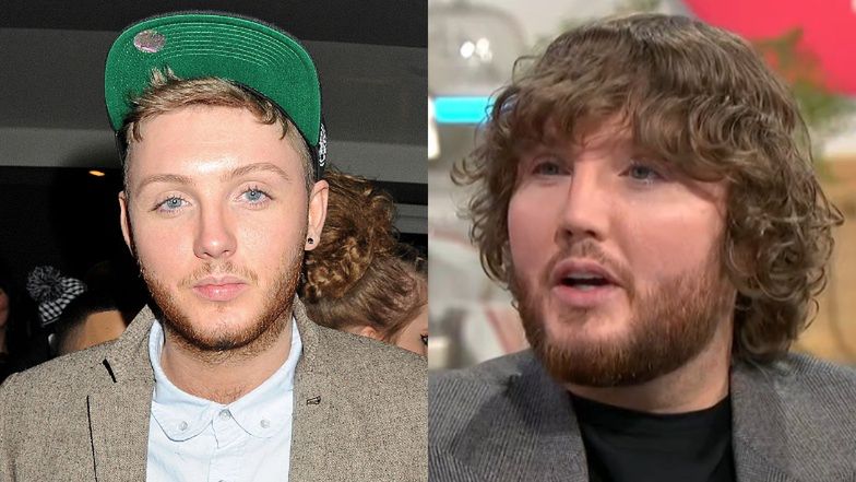 James Arthur kiedyś i dziś