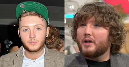 James Arthur zaskakuje NOWĄ TWARZĄ. Bardzo się zmienił od czasów "X Factor"?