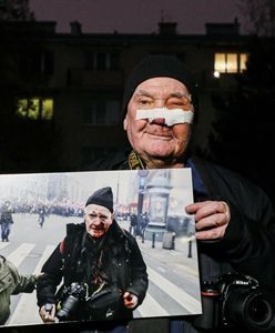 Marsz Niepodległości. Postrzelony fotoreporter żąda odszkodowania. Podał kwotę