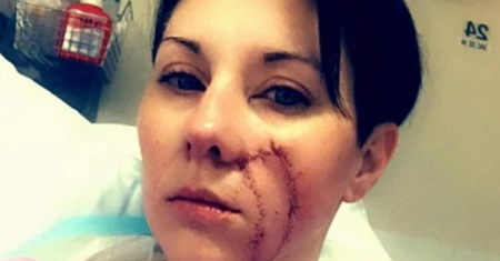 Mama odkryła, że po ciąży jej pieprzyk powiększył się trzykrotnie