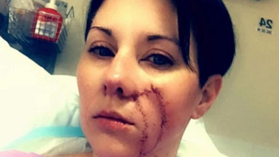 Mama odkryła, że po ciąży jej pieprzyk powiększył się trzykrotnie