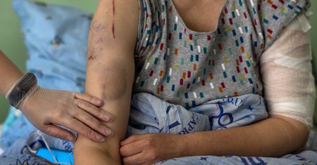 Rosjanie torturują Ukraińców w Chersoniu. "Najgorsze były ślady oparzeń na genitaliach"