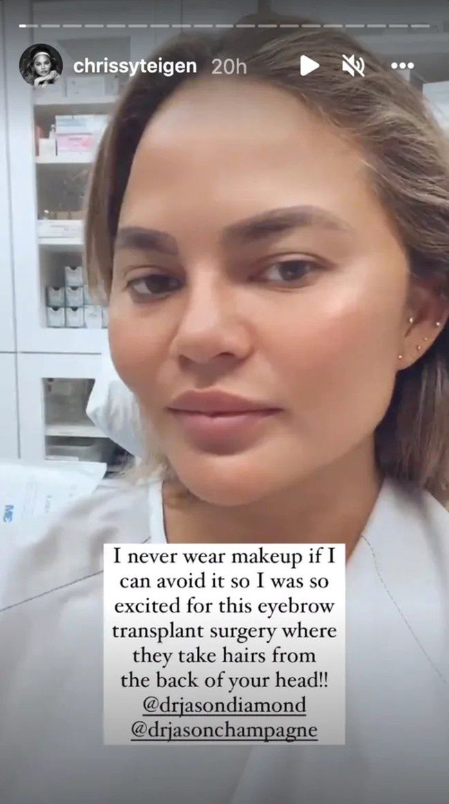 Chrissy Teigen 