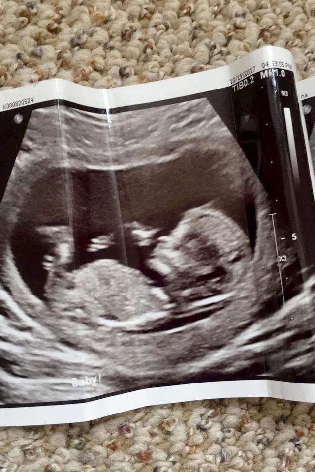 Kobieta twierdzi, że jej dziecko prawidłowo się rozwija