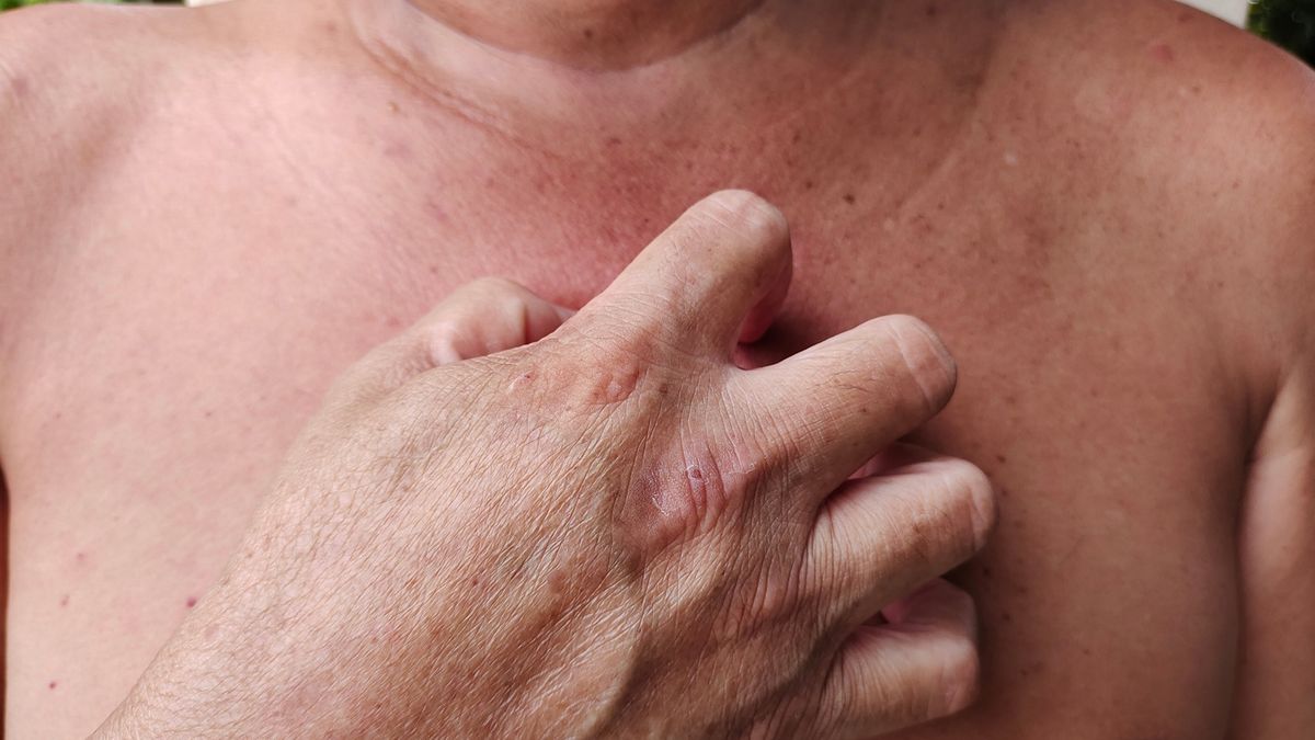 Picie wody z niesprawdzonych źródeł sprzyja zakażeniu pasożytami