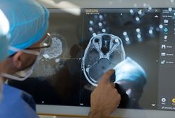 COVID-19 może powodować trwałe uszkodzenia mózgu. Najnowsze badania