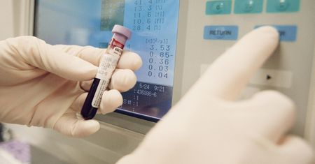 Lipoproteina (a) to cichy zabójca. Polacy nie wiedzą, że trzeba ją badać