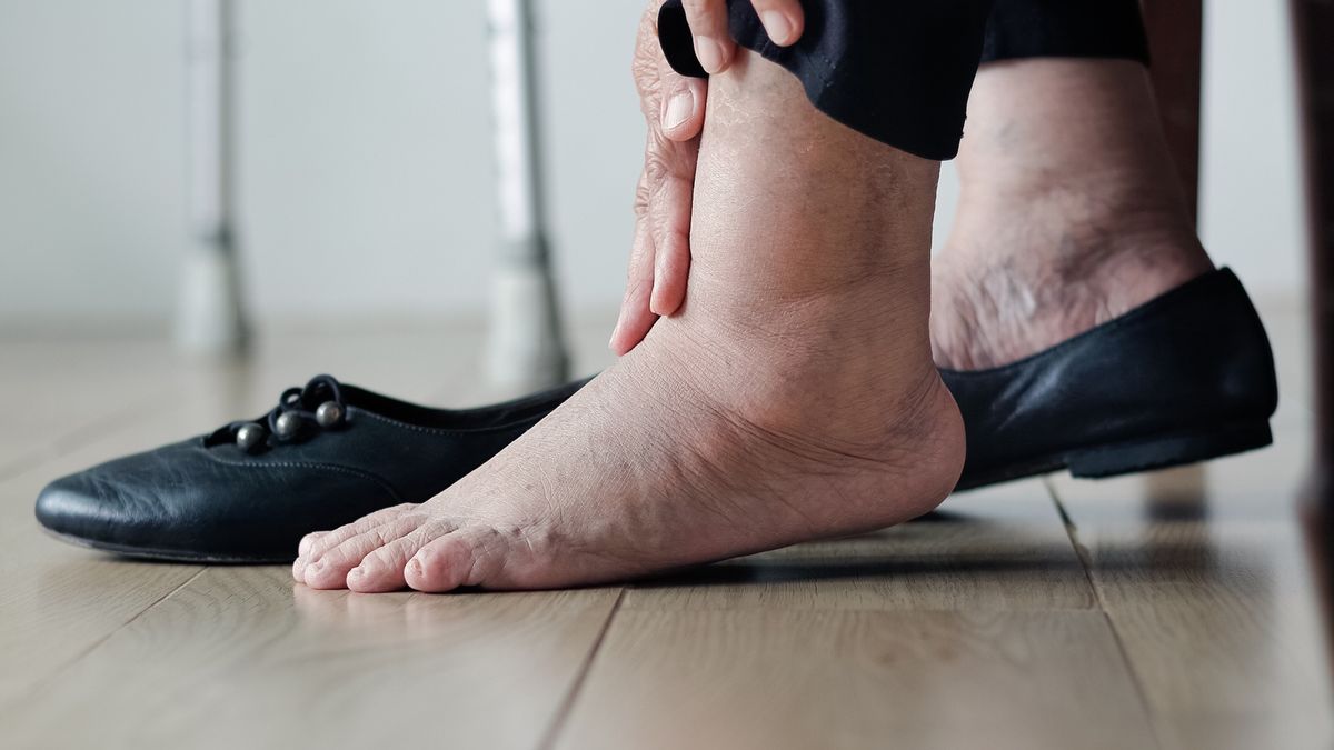 Zauważyłeś ten objaw? Może pojawić się na stopach