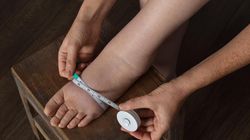 "Test skarpetki". Pomoże wyłapać pierwsze sygnały niewydolności serca