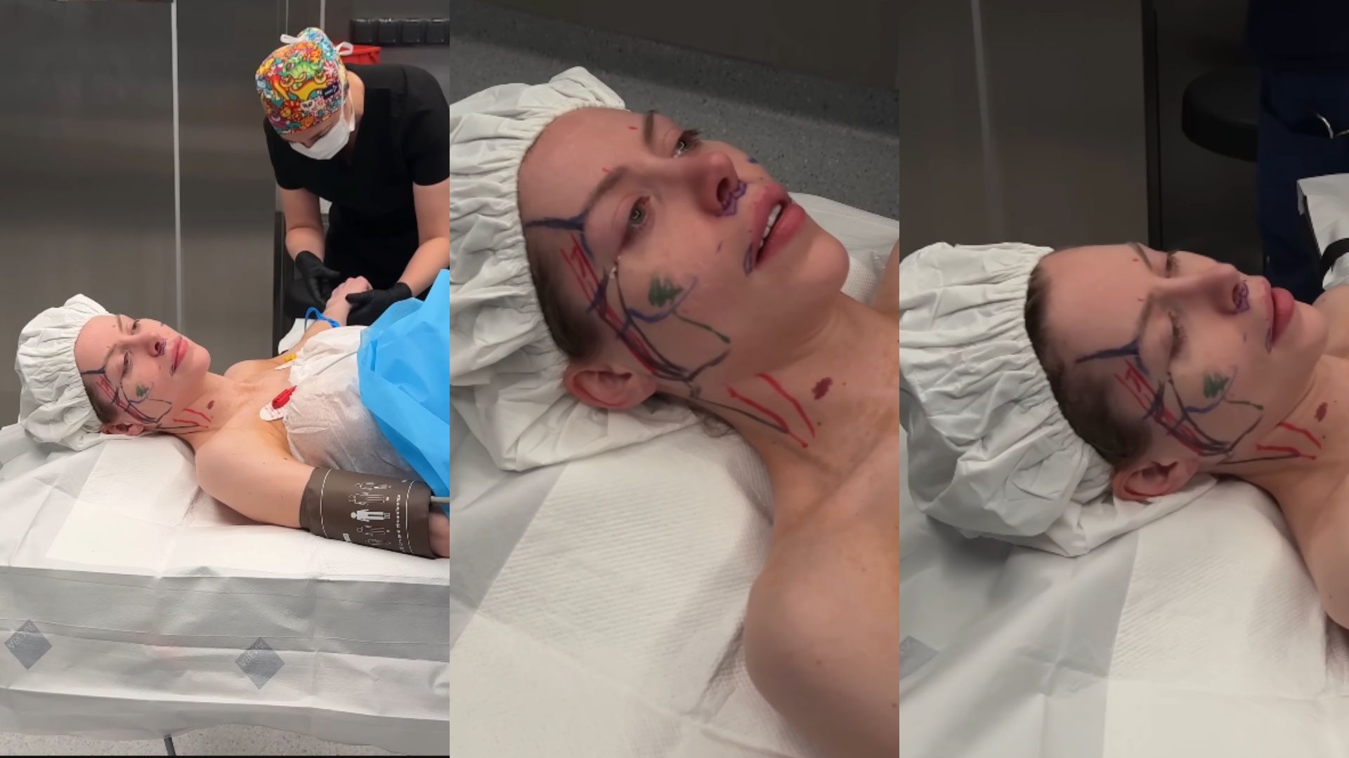 Julia von Stein podczas operacji plastycznej