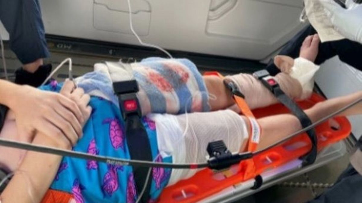 Lucas Cruz został wyciągnięty przez rekina z łódki. Przeżył tylko dzięki pomocy rodziny 