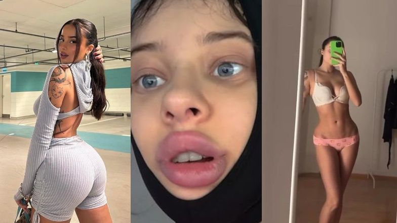 Fagata odsłania kulisy operacji plastycznych