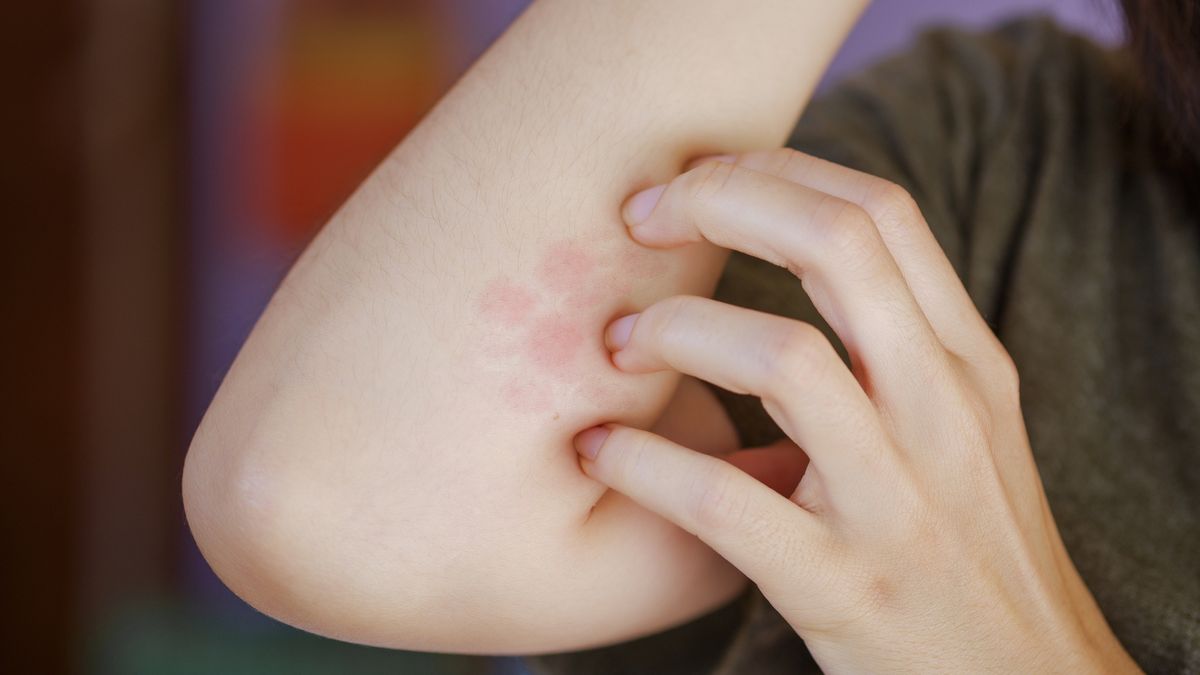 woman is scratching arm
A woman is scratching a red blistered arm due to a foreign body intolerance or an insect bite.
Images we create and what actual
itchy rash