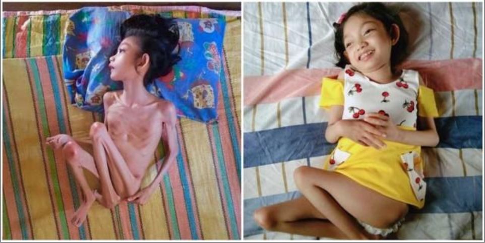 Dzisiaj Filipinka już ma się znacznie lepiej (Facebook)