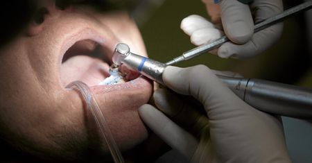 Koronawirus w Polsce. Niemiłe zaskoczenie u dentystów. "Doliczają do wizyty 100 zł"