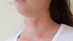 Omikron "zjada" kolagen? "Covidowa skóra" to problem, który dotyka wielu zakażonych nowym wariantem