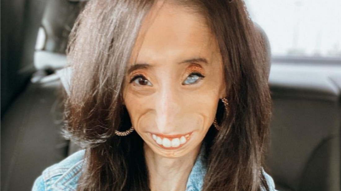 Została nazwana "najbrzydszą kobietą świata". Złośliwy przydomek zmotywował ją do działania