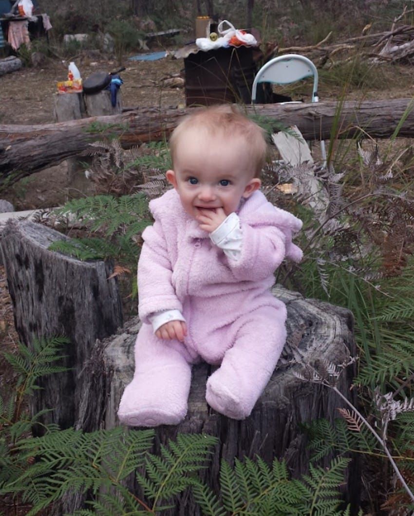 Dziewczynka posiada widoczną asymetrię ciała