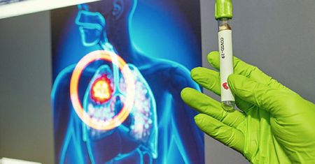 Koronawirus. U bezobjawowych COVID-19 też powoduje uszkodzenia w płucach