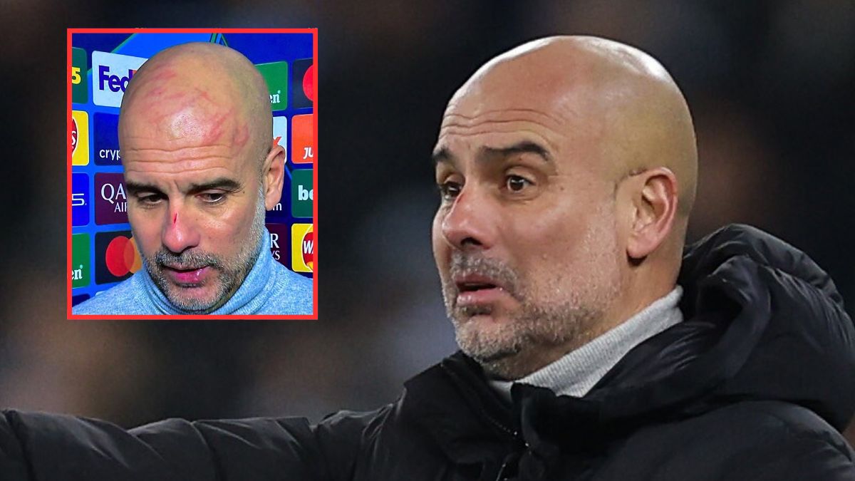 Pep Guardiola okaleczył się po meczu Ligi Mistrzów