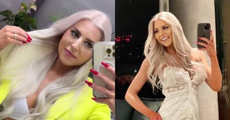 Tak Julia von Stein wygląda BEZ DOCZEPÓW! Spora różnica... (FOTO)