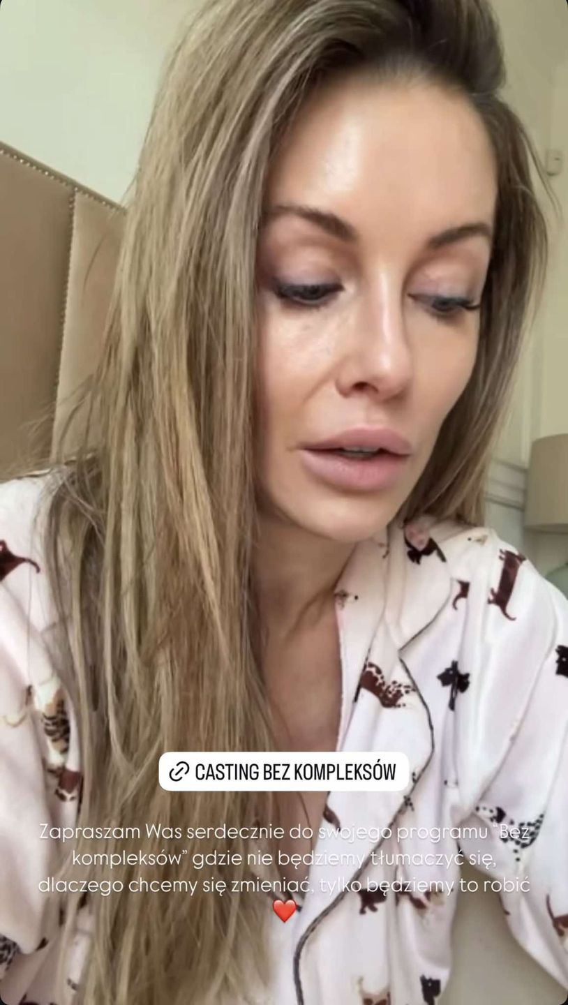 Małgorzata Rozenek prezentuje "naturalne" oblicze z rana