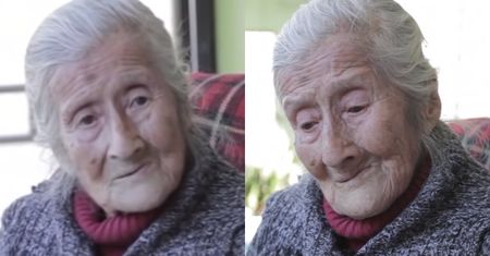 91-latka nosiła w brzuchu 60-letnie "dziecko z kamienia". Zaskakujące odkrycie lekarzy
