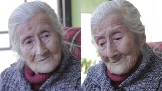 91-latka nosiła w brzuchu 60-letnie "dziecko z kamienia". Zaskakujące odkrycie lekarzy