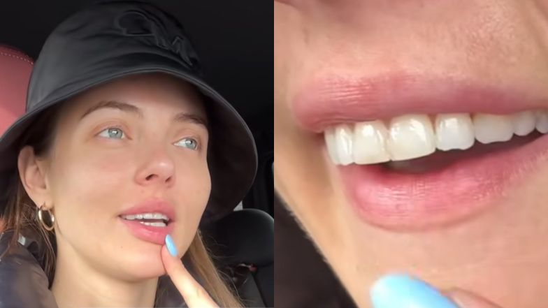 Marcela Leszczak rozpacza nad swoimi zębami. Wydała już krocie