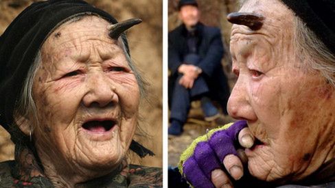 Kobieta z koźlim rogiem na czole 1