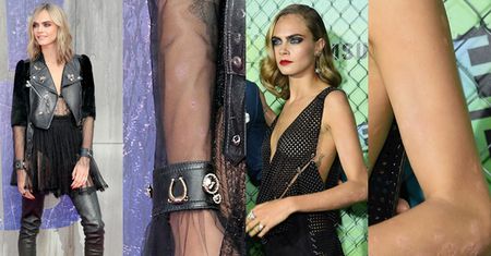 Cara Delevingne już nie zakrywa śladów łuszczycy (FOTO)