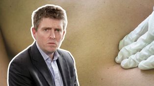 Sześć rad, jak uniknąć raka. Onkolog mówi o kluczowych decyzjach