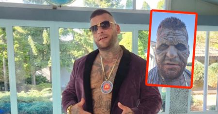"Popek" przeraził swoich fanów. Tylko spójrz na jego twarz