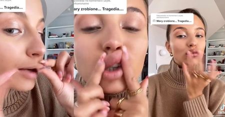 Julia Wieniawa zarzeka się, że nie OSTRZYKNĘŁA sobie ust: "Mogę je marszczyć! Dzióbki robić! Nie ma tutaj NIC!"