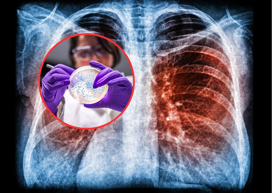 Przez 2 lata badali ludzi, którzy przeszli COVID. Fatalne wnioski