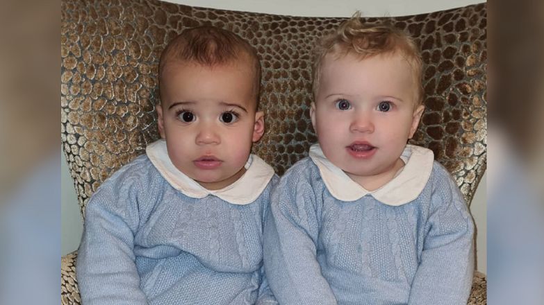 Ludzie nie wierzą, że chłopcy są bliźniakami. Wszystko przez ich niecodzienny wygląd
